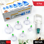 Therapy cupping kit with suction pumps, designed for muscle relief.